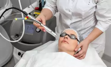 laser facial